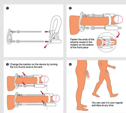 Safe & Comfortable Male Enhancement Penis Extender Kit for Length & Girth Growth